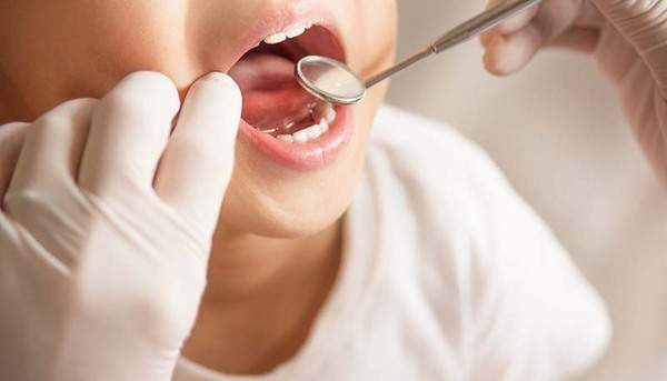 子どもの口内を歯科医師がチェックしている写真