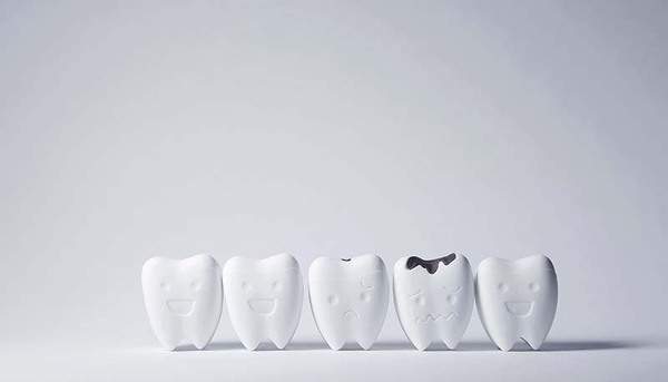 健康な歯と虫歯・虫歯になりかけの歯の模型