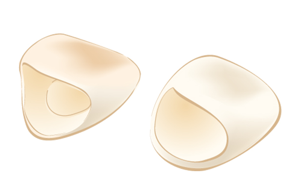 麻布十番の歯医者さんで使用する被せ物と詰め物のイメージのイラスト