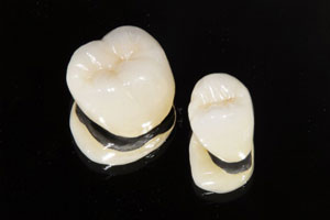 メタルボンドクラウン