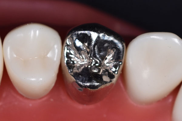 シルバークラウン