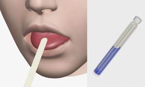 唾液の中のミュータンス菌の検査方法