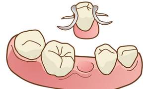 入れ歯のイラスト