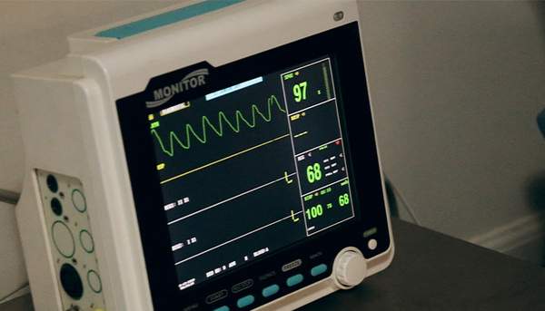 心電図のイメージ写真