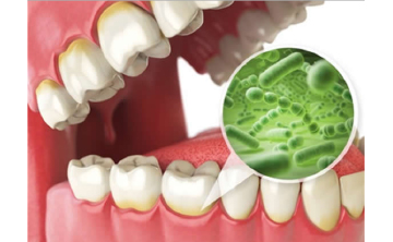 歯に付着する細菌のイメージ