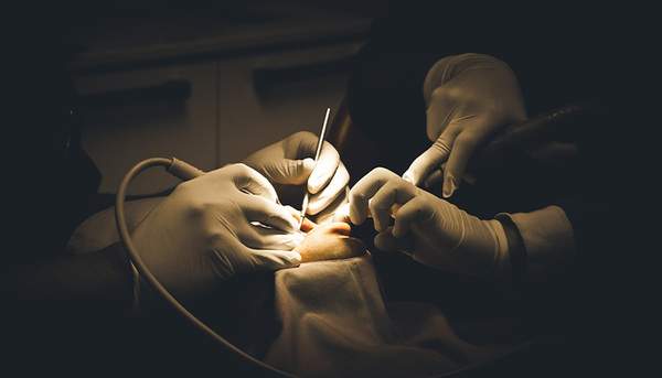 メリットとデメリットq