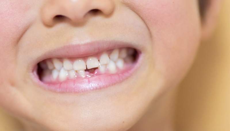 歯の生え変わり