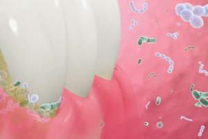 口腔内のバイオフィルムのイメージ