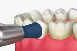 ブラシで歯の表面を磨いている口腔内のイメージ