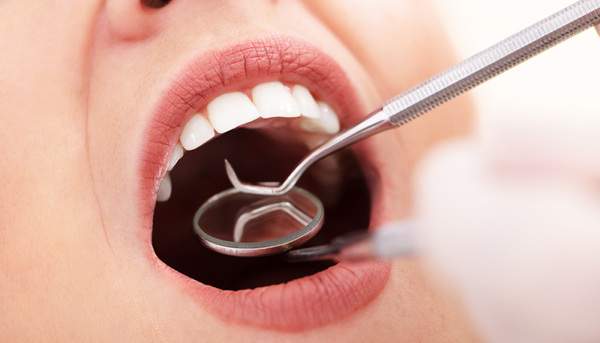 歯科器具でお口の中を確認している写真