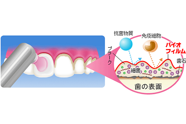バイオフィルムと除去方法の説明イラスト