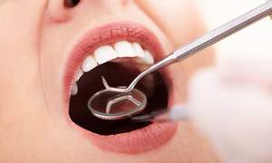 口腔内チェック