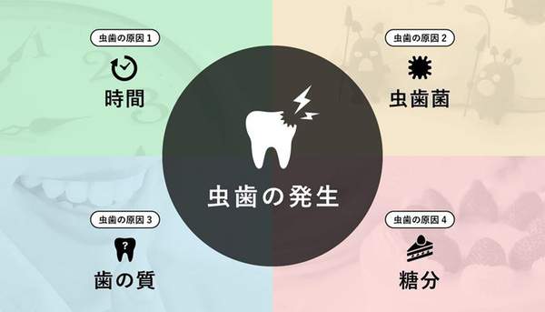 虫歯のメカニズムを説明したイラスト