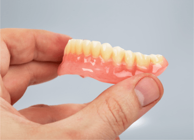 インプラントと組み合わせるための入れ歯